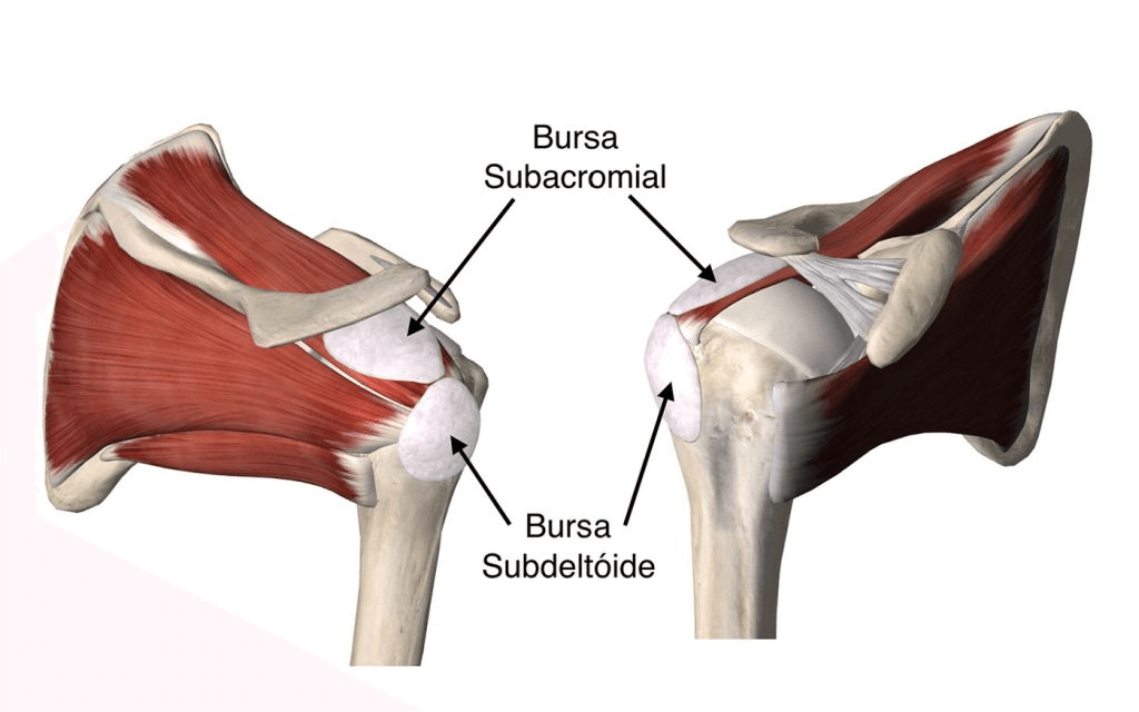 Bursite ombro