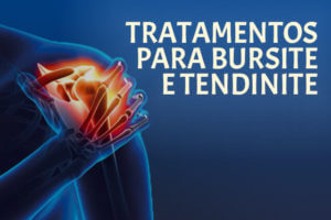 tratamento-para-bursite