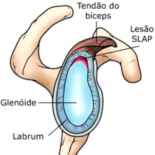 Tendão do bicepes