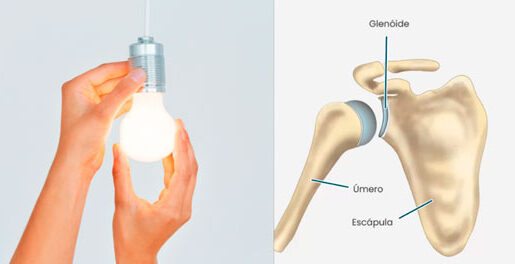 Comparação da dor no ombro com o encaixe da lampada